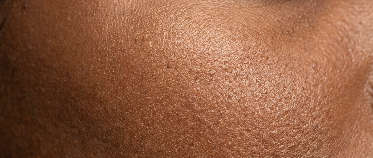 Macro detail of Fitzpatrick V skin